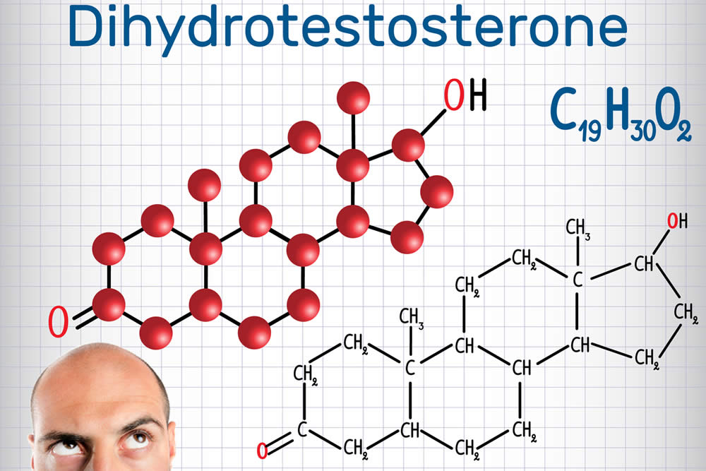 дигидротестостерон